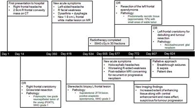 Case report: Polymorphous low-grade neuroepithelial tumor of the young and supratentorial ependymoma diagnosed in an adult male